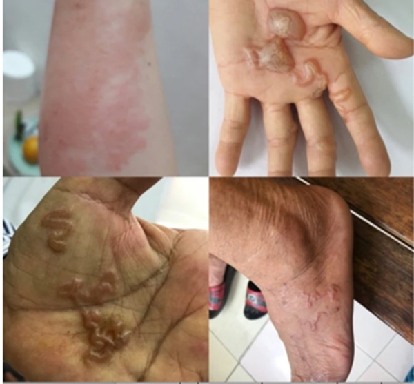 Cảnh báo nhiễm bệnh từ thú cưng-2