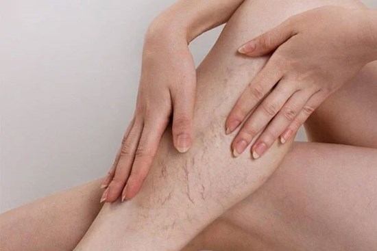 Căn bệnh rình rập dân văn phòng, nghĩ đơn giản nhưng nguy cơ khó lường