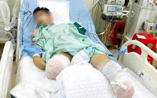 Vĩnh Phúc: Nam sinh bị tàu hỏa cán được xét đặc cách tốt nghiệp THPT-1