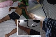 Giải cứu người đàn ông bị rắn hổ mang chui vào quần lúc đang ngủ