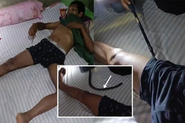 Giải cứu người đàn ông bị rắn hổ mang chui vào quần lúc đang ngủ-1