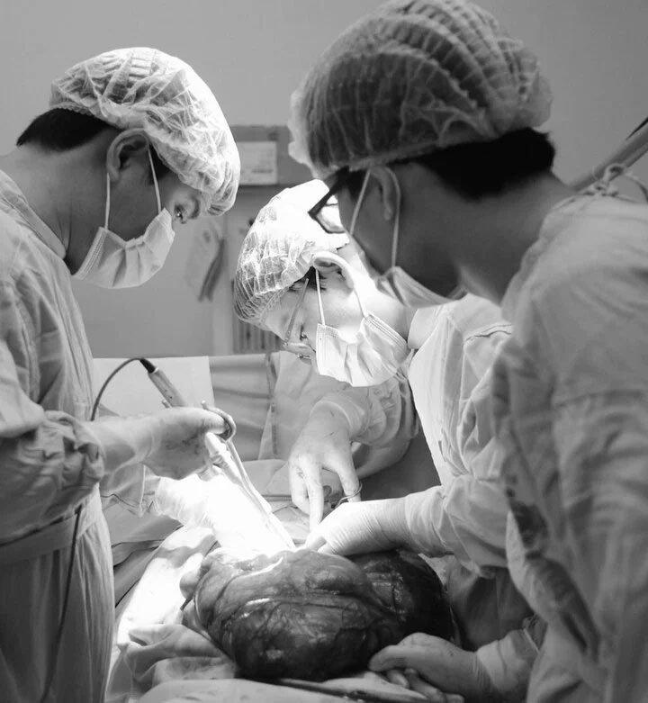 Tưởng tăng cân, ai ngờ mang khối u nặng 8kg trong bụng-1