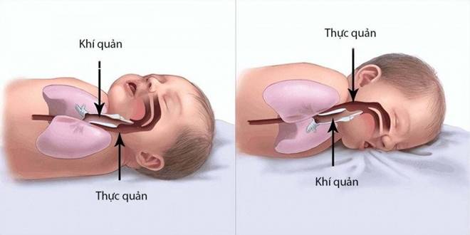 Bé gái 2 tuổi ra đi mãi mãi lúc đang nằm ngủ, người mẹ gục ngã khi biết lỗi do mình-3