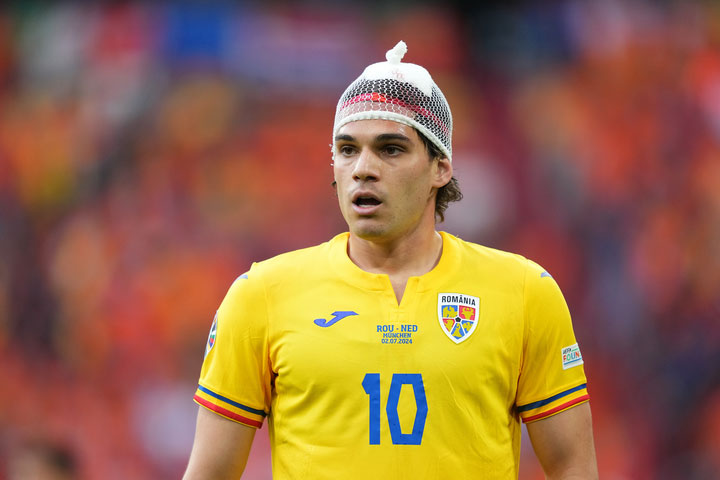 Vì sao cầu thủ EURO 2024 đội chiếc mũ đặc biệt trông như lưới bọc hoa quả?-1