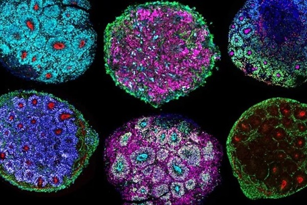 Tập thể thao 30 phút/ ngày có thể tiêu diệt khối u trong máu của bệnh nhân ung thư-1