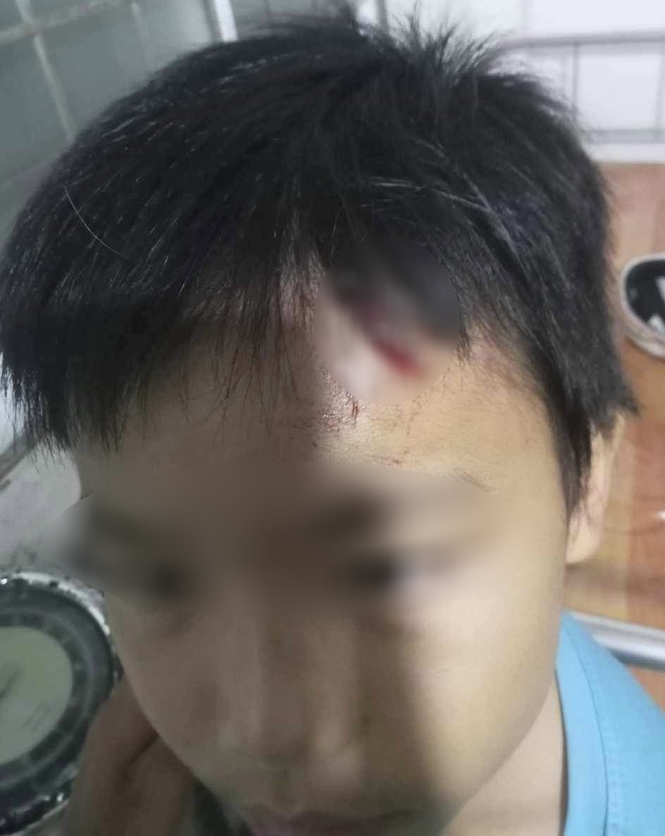 Điều tra vụ bé trai 10 tuổi nghi bị mẹ kế tiếp tục bạo hành-1