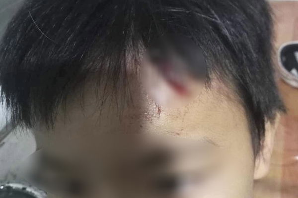 Lời kể của bé trai 10 tuổi nghi bị mẹ kế bạo hành ở Cà Mau-2