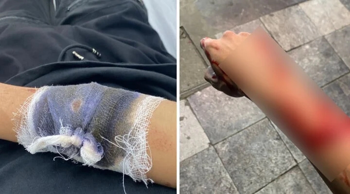 Thanh niên bị chém, cướp xe máy trước Nhà hát Lớn Hà Nội-1