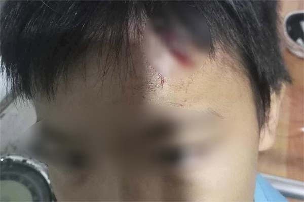 Chủ tịch tỉnh Cà Mau chỉ đạo làm rõ tin tố giác mẹ kế bạo hành con chồng-2