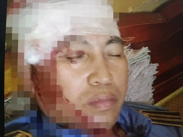 Phụ lái tàu hỏa bị ném đá trúng đầu, nhập viện cấp cứu-1