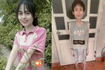 Cô gái Hưng Yên nặng 18kg hạnh phúc báo tin vui-5