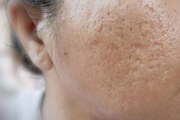 5 sai lầm cơ bản gây ra nếp nhăn mắt, khiến bạn trông già hơn tuổi-2