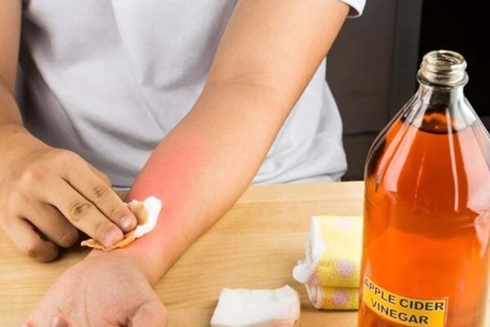 Cách làm dịu tay bỏng rát do dính ớt