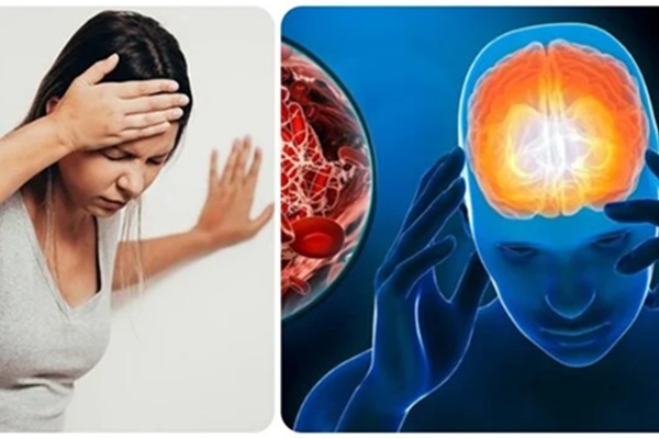 7 cách phòng ngừa đột quỵ từ sớm-2
