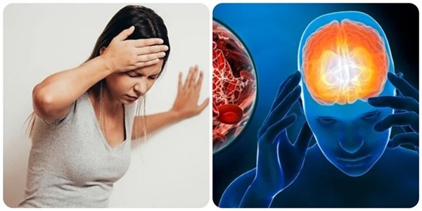 4 dấu hiệu cảnh báo cơn đột quỵ cần xử trí nhanh-1