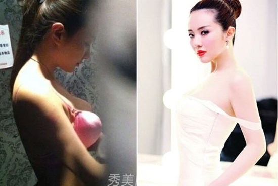 Hé lộ sự thật việc các minh tinh bị chụp lén: Thủ đoạn để nổi tiếng!