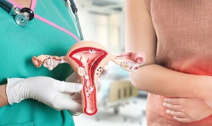 Lần đầu đi khám phụ khoa ở tuổi 63, người phụ nữ phát hiện mắc ung thư-1