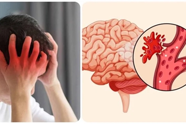 Bất ngờ với bài tập hiệu quả để hồi phục sau đột quỵ-2