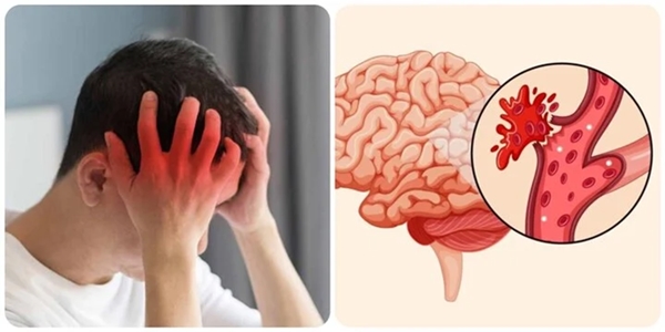 6 thói quen xấu dễ gây đột quỵ mùa hè, nhiều người không biết vẫn làm-1