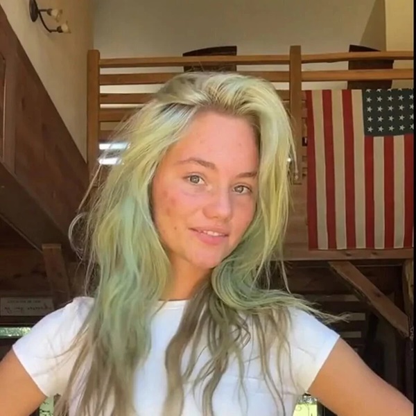 Xuống bể bơi, cô gái sốc khi tóc bỗng hóa xanh: Thủ phạm bất ngờ-1