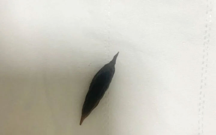 Đau dữ dội sau ăn yến chưng, đi khám phát hiện dị vật là hạt táo đỏ-2