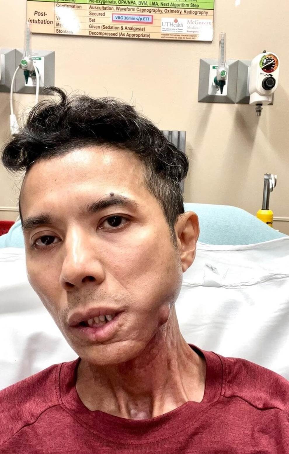 Kasim Hoàng Vũ: Nam thần nhạc rock trở nên tiều tụy vì bạo bệnh-5