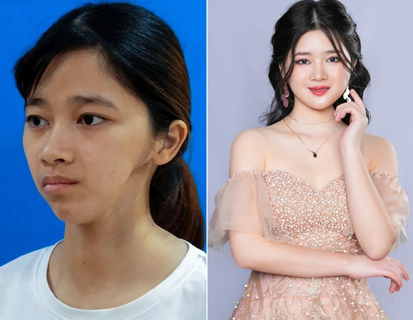 Từng bị bạn học đánh vì gương mặt lạ, cô gái Ninh Bình lột xác ngỡ ngàng-2