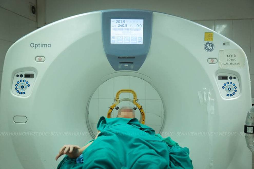 Ca phẫu thuật đặc biệt cho thanh niên 17 tuổi cơ thể cong như con tôm-1