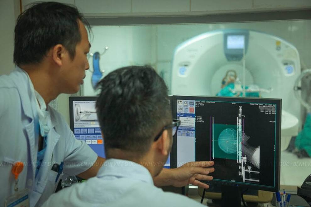 Ca phẫu thuật đặc biệt cho thanh niên 17 tuổi cơ thể cong như con tôm-2