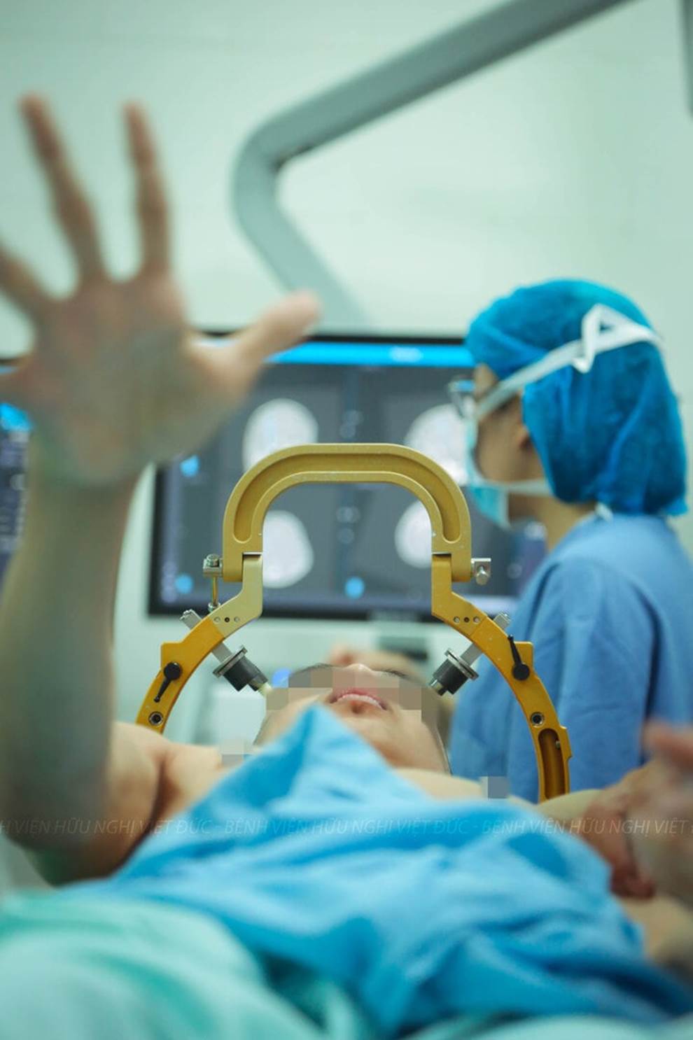 Ca phẫu thuật đặc biệt cho thanh niên 17 tuổi cơ thể cong như con tôm-3