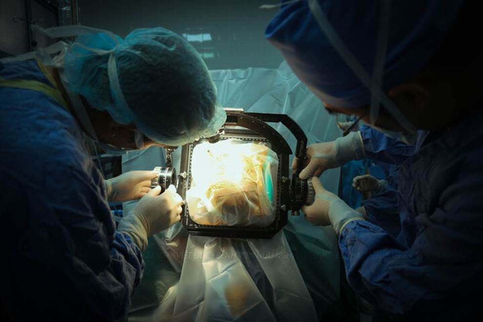 Ca phẫu thuật đặc biệt cho thanh niên 17 tuổi cơ thể cong như con tôm-5