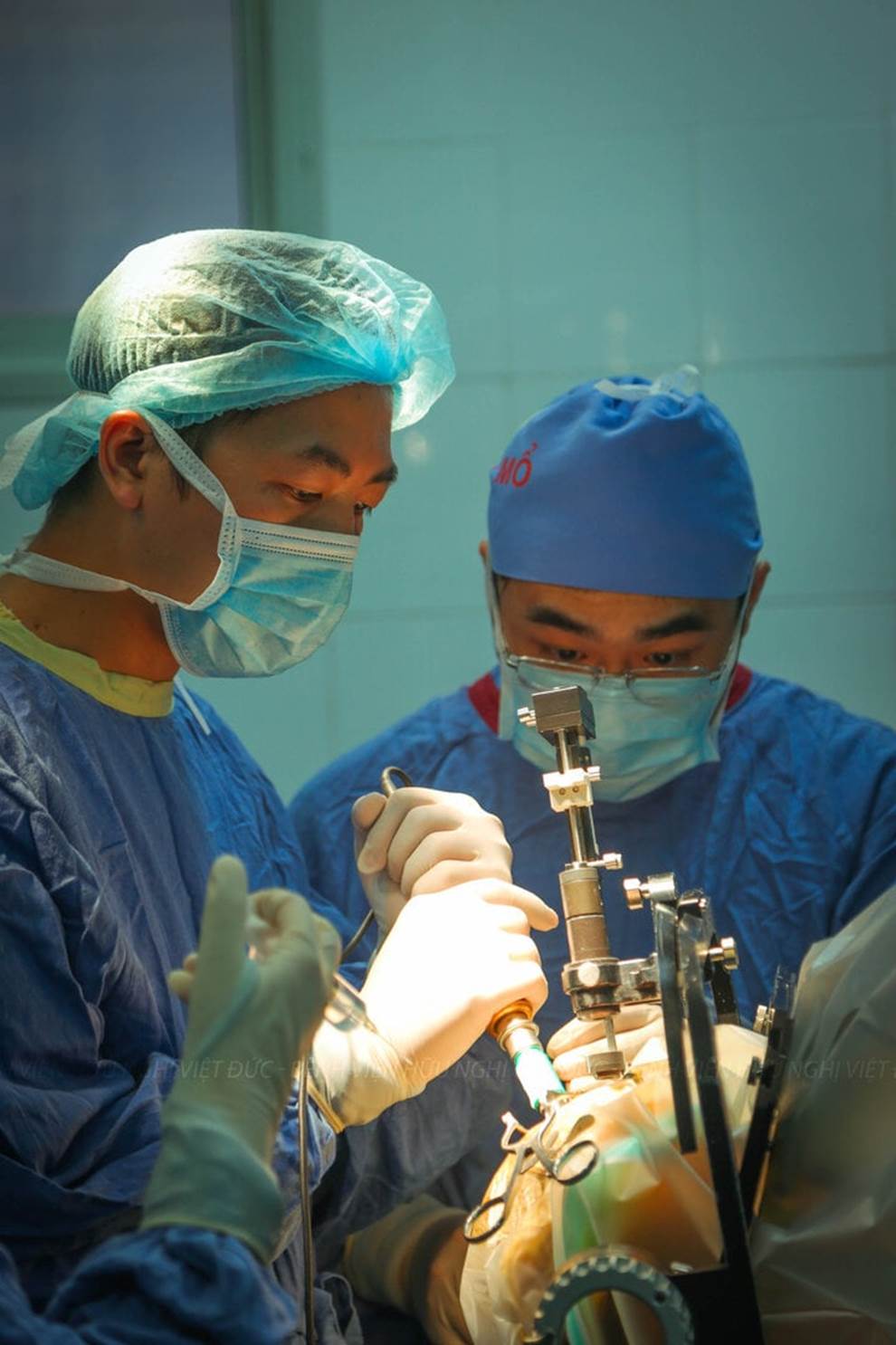 Ca phẫu thuật đặc biệt cho thanh niên 17 tuổi cơ thể cong như con tôm-7