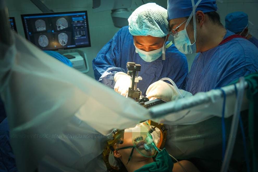 Ca phẫu thuật đặc biệt cho thanh niên 17 tuổi cơ thể cong như con tôm-8