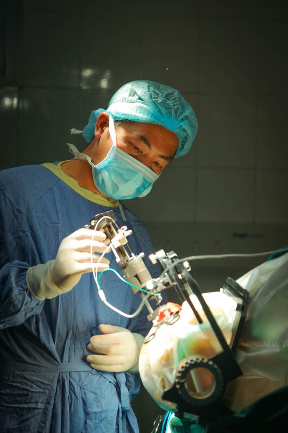 Ca phẫu thuật đặc biệt cho thanh niên 17 tuổi cơ thể cong như con tôm-9