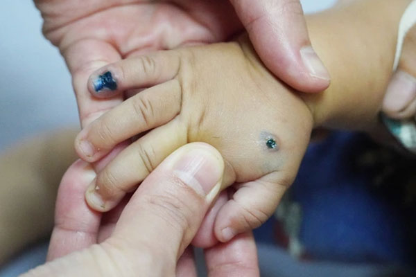 Bác sĩ chỉ cách giữ ấm cho trẻ trong mùa đông-2