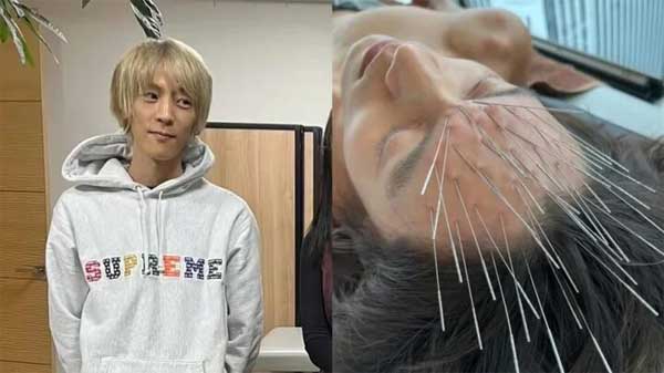 Rộ mốt châm kim đầy đầu để giết chết suy nghĩ, 30 phút tốn 34 triệu đồng-2