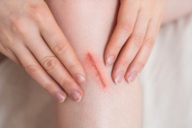 Người đàn ông mắc bệnh tiểu đường phải chạy thận suốt đời chỉ vì bỏ qua dấu hiệu này-2