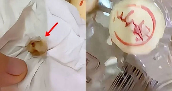 Cô gái sốc nặng khi phát hiện răng người trong bánh trung thu-1