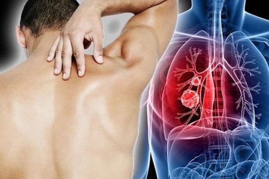 Người đàn ông 29 tuổi bất ngờ phát hiện ung thư phổi, thừa nhận có một sai lầm nhiều nam giới Việt mắc phải
