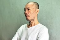 Ca sĩ Tô Thanh Phương 'Đất phương Nam' gãy xương hàm vì ngã lầu