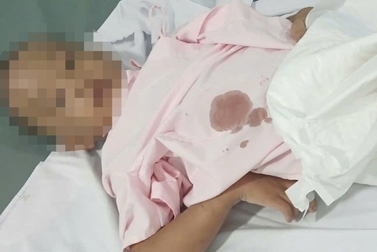 Bắt người cha cùng nhân tình vụ bé trai 6 tuổi nghi bị bạo hành