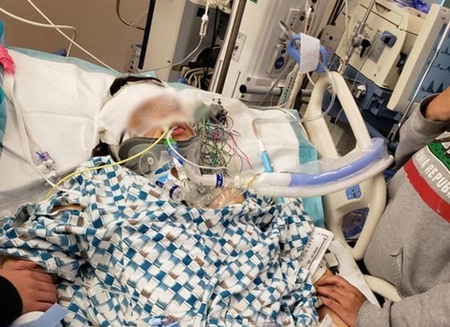 Thanh niên 19 tuổi suýt chết vì đột quỵ đã bỏ qua nhiều dấu hiệu cảnh báo bệnh này-1