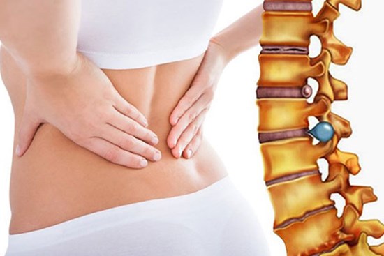 Khi nào cần phẫu thuật thoát vị đĩa đệm?