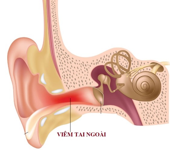 Cần làm gì khi trẻ kêu bị đau tai?- Lời khuyên của bác sĩ-1