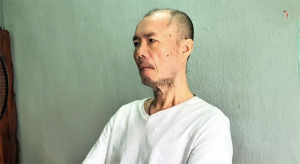 Ca sĩ Tô Thanh Phương Bài ca đất phương Nam: Tôi sốc vì sợ bị mù-1