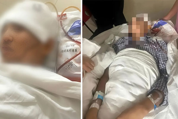 Người đàn ông 51 tuổi liệt nửa người vì ngồi ô tô kiểu này-2