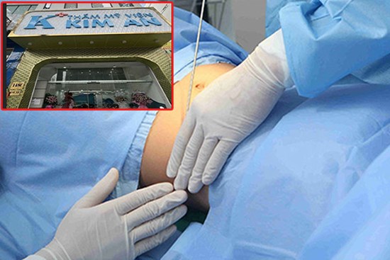 TPHCM: Thẩm mỹ viện không phép cử nhân viên trình độ lớp 8 hút mỡ bụng cho khách hàng