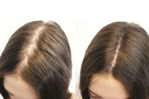 Tuyệt chiêu giúp da đầu bớt nhờn, tóc đỡ bị bết-5