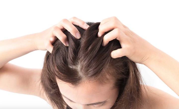 Tuyệt chiêu giúp da đầu bớt nhờn, tóc đỡ bị bết-1