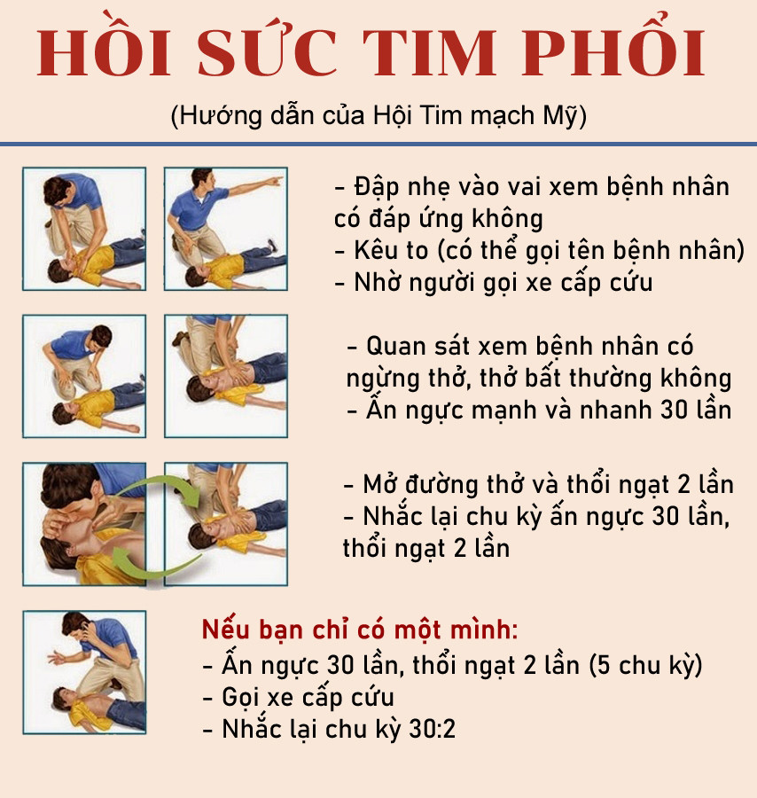 Bác sĩ ngừng tim trên sân tennis, thoát chết nhờ 3 người bạn-2